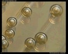 Stenotrophomonas maltophilia